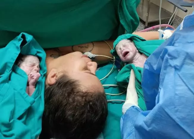 Jovem de 24 anos dá à luz trigêmeas idênticas após gravidez raríssima em Rondônia